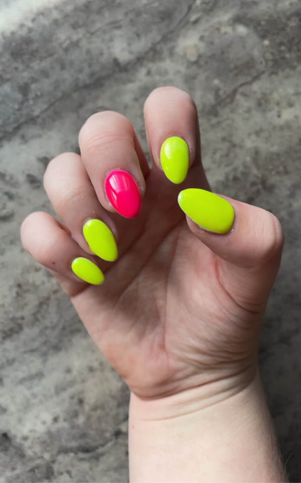Neon Yellow And Pink Nails Design – Vibrant Guide